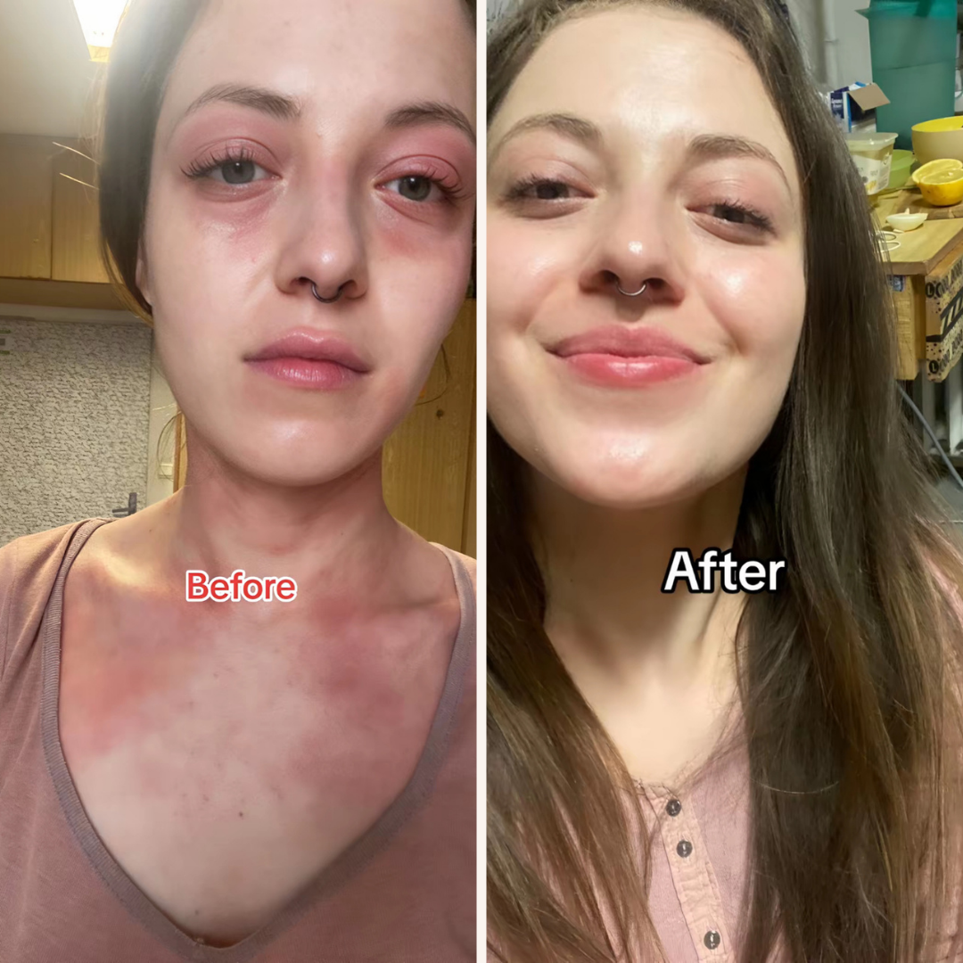 Dermacalm Relief