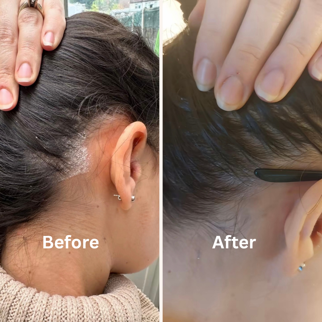 Dermacalm Relief